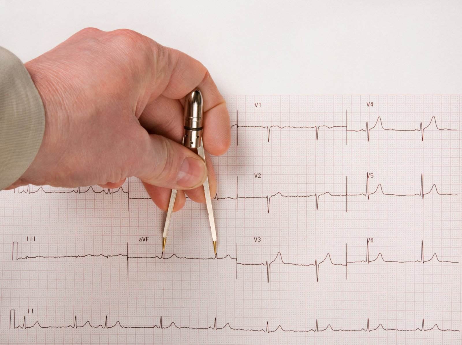 Using ECG calipers