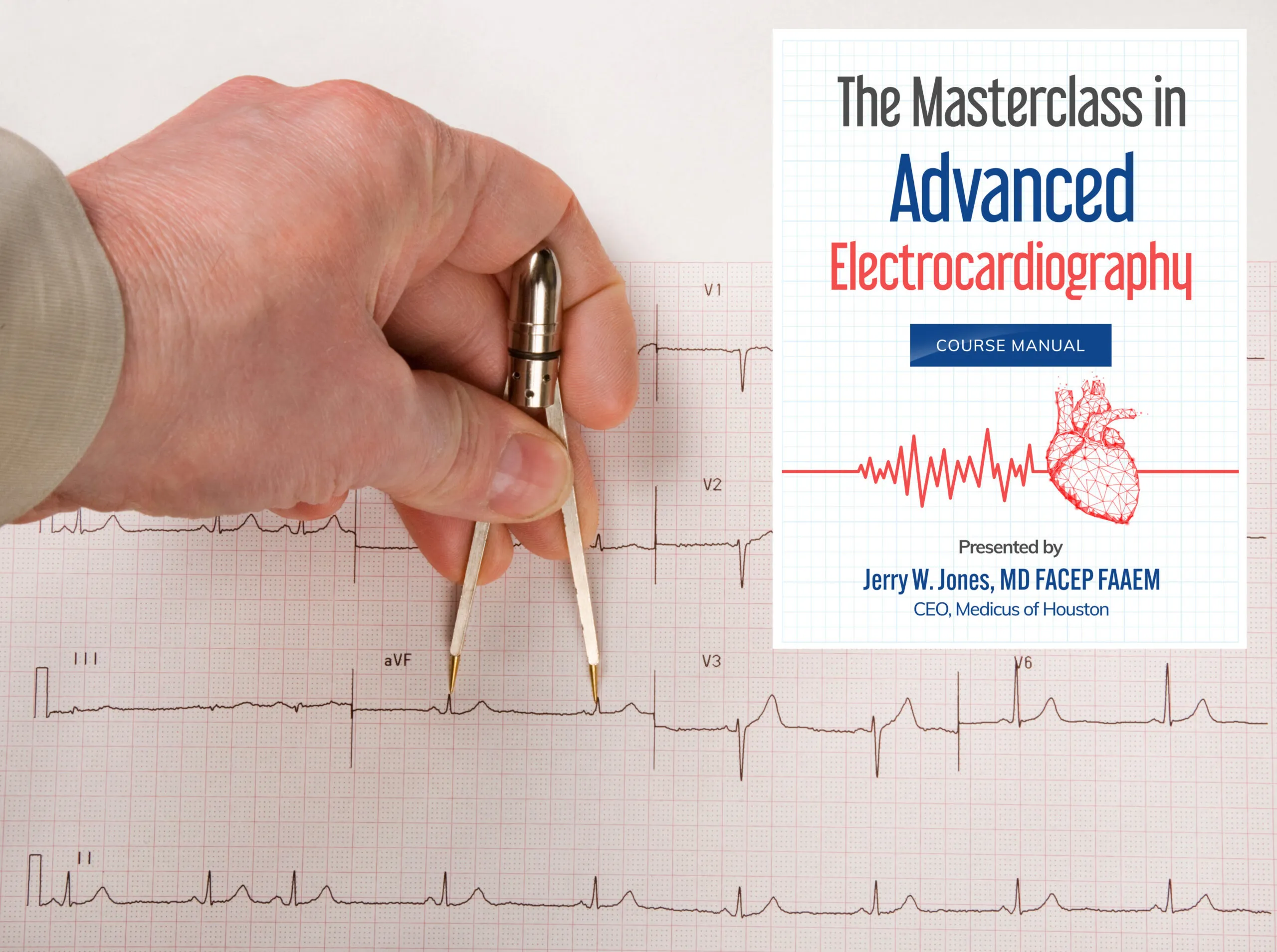 Using ECG calipers
